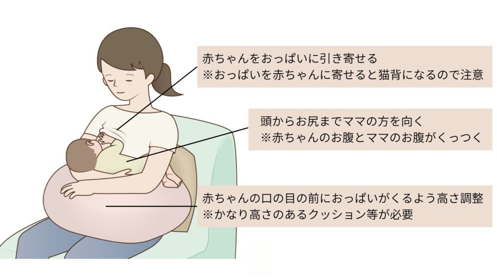 乳腺炎のセルフケア、自宅でできる対処法