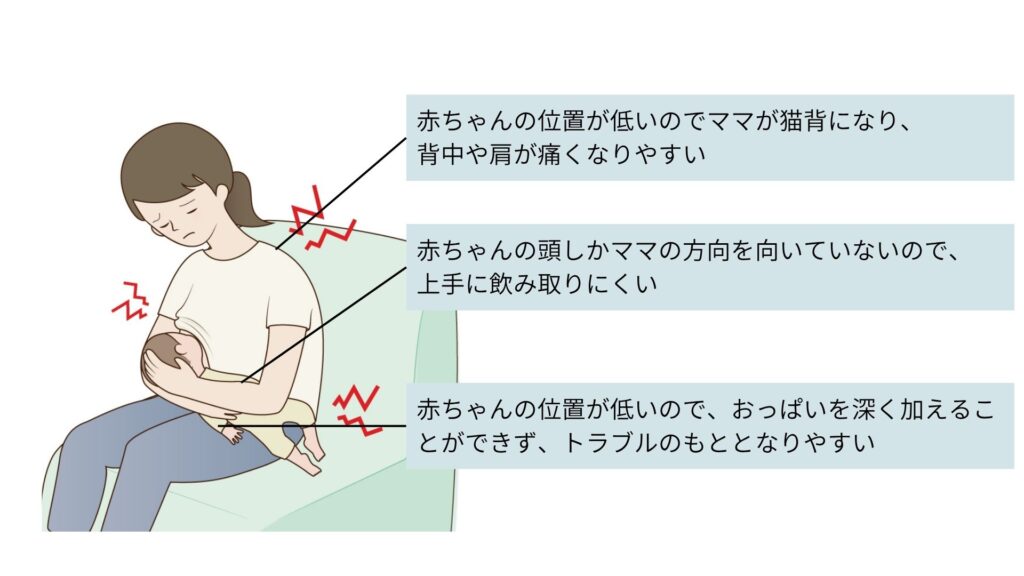 乳腺炎のセルフケア、自宅でできる対処法