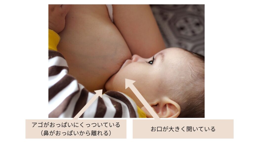 乳腺炎のセルフケア、自宅でできる対処法