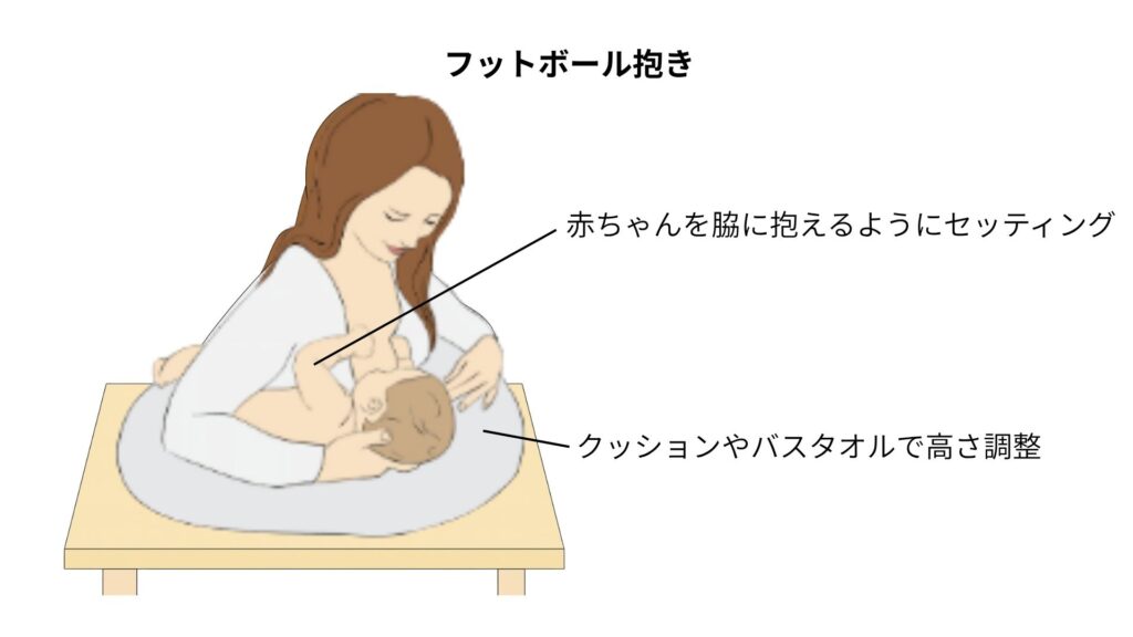 乳腺炎のセルフケア、自宅でできる対処法