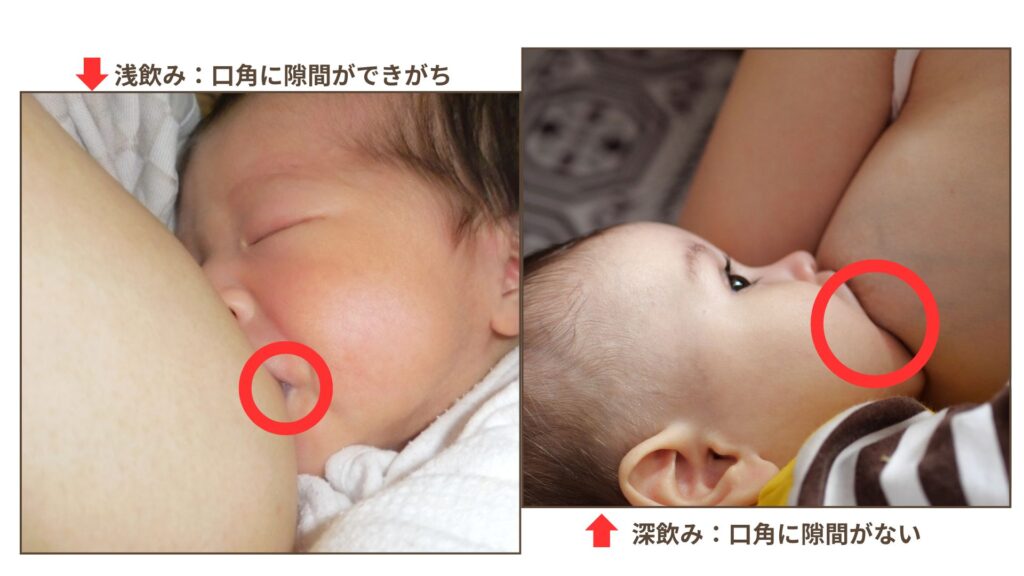 赤ちゃんが母乳を飲み取りにくい抱っこ姿勢の例２